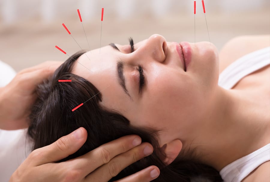 acupuncture-cosmetics