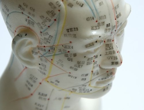 Acupuncture – What it is. How it works. What it can help