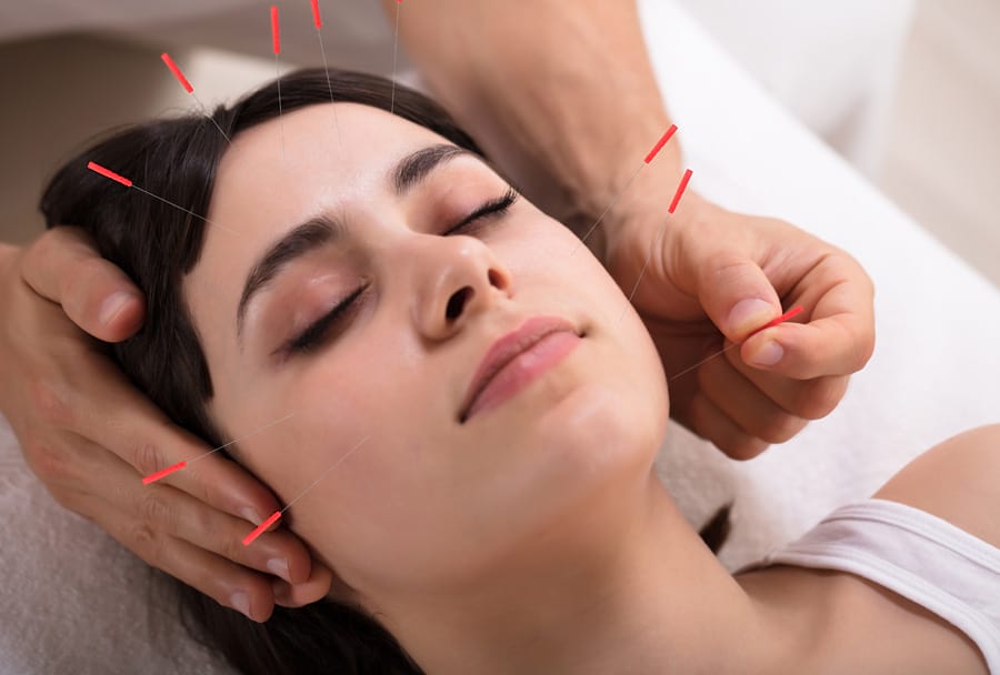 acupuncture-in-surrey-overview