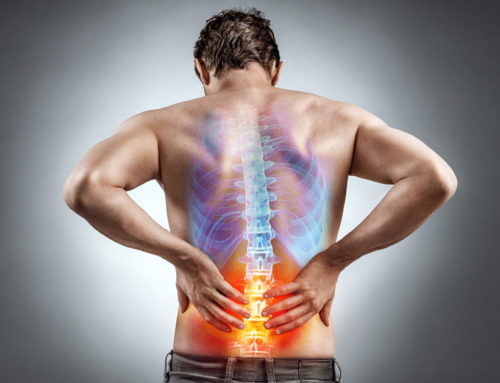 Acupuncture for Back Pain