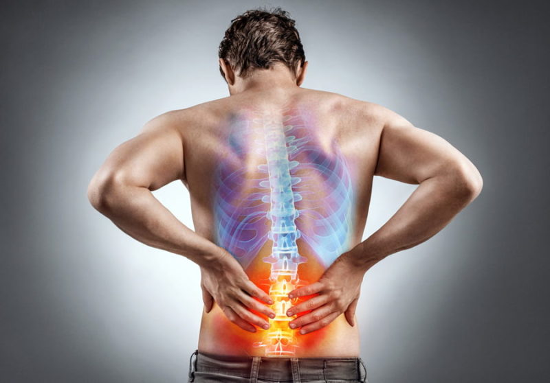 Acupuncture for Back Pain Acupuncture In Surrey