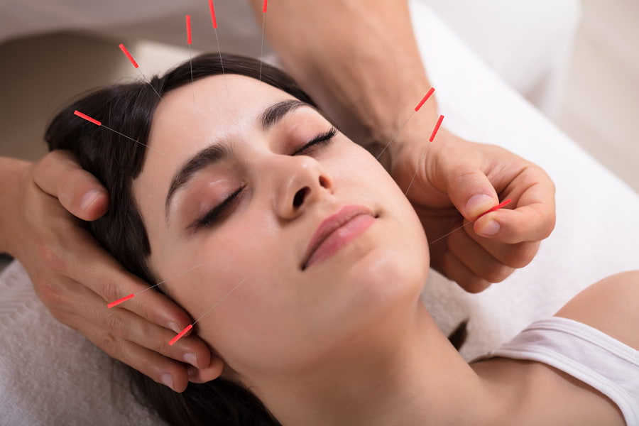 cosmetic-acupuncture-in-surrey-overview Cosmetic acupuncture in surrey treatments