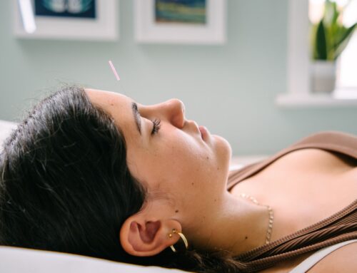 Acupuncture and Anxiety